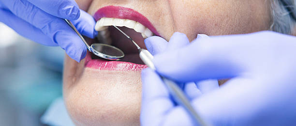 Best Emergency Treatment for Dental Infections or Abscesses in Colfax, LA